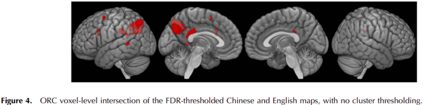 Figure 4. ORC voxel-level intersection of the FDR-thresholded Chinese and English maps, with no cluster thresholding.