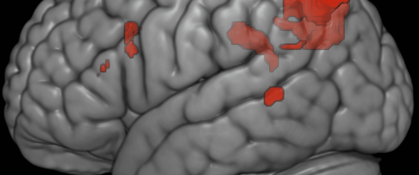 Brain scan from ORC research. Gray brain scan on black background with red markings on small brain areas towards the center.